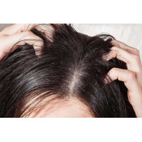 Những thói quen này đang gây hại nghiêm trọng cho da đầu của bạn