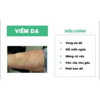CÁC BỆNH DA LIỄU THƯỜNG GẶP