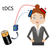 Giới thiệu chung về máy kích thích xuyên sọ bằng dòng điện một chiều đều tDCS
